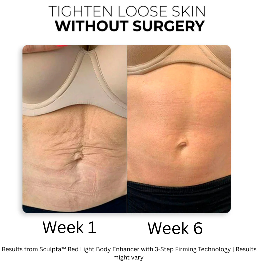 Sculpta™ | Red Light Body Enhancer with 3-Step Firming Technology